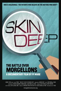 دانلود مستند Skin Deep: The Battle Over Morgellons 2019104233-645384223